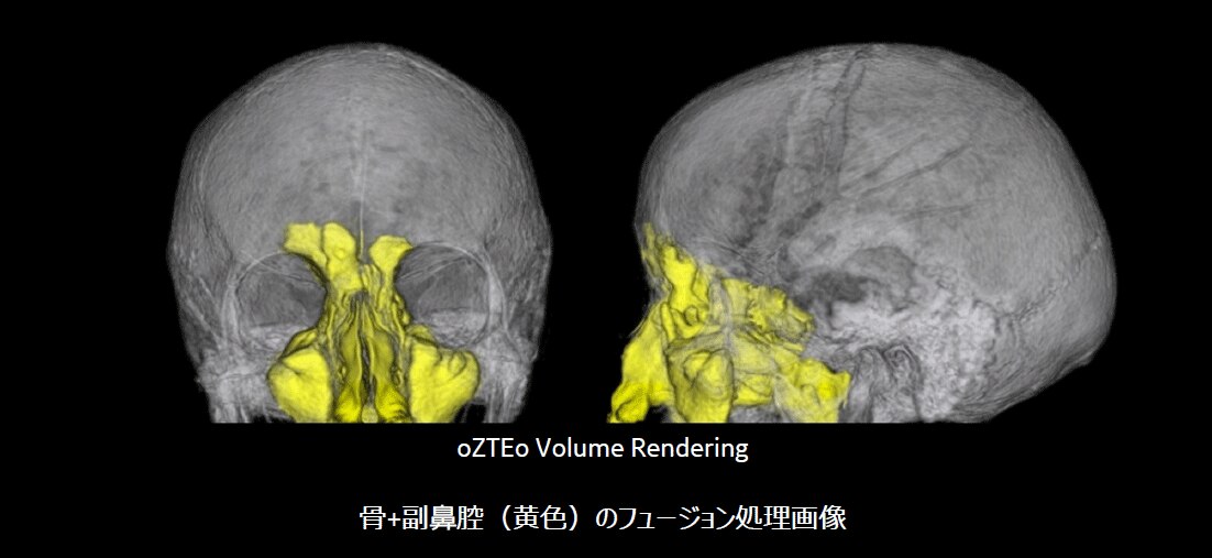Cross-section-and-3D-view-of-